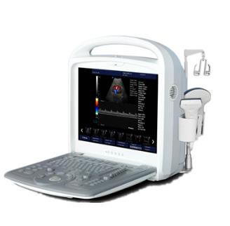 便携式全数字彩色多普勒超声诊断仪BLS-X3